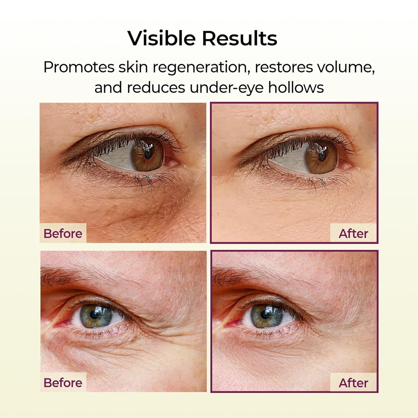 Final 3 Hours: 60%OFF🔥Gifted Collagen Boost 5-Step Set Calcium Collagen Balm for Firming & Pore Care