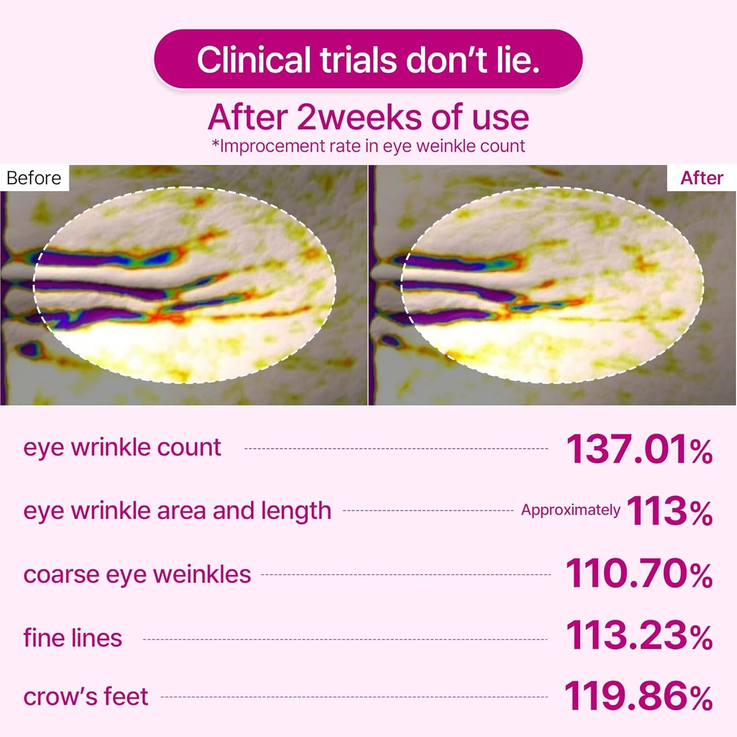 Final 3 Hours: 60%OFF🔥Gifted Collagen Boost 5-Step Set Calcium Collagen Balm for Firming & Pore Care